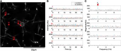 Actively Driven Fluctuations in a Fibrin Network